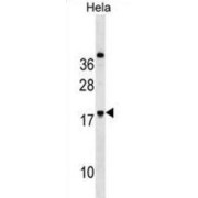 RING Finger Protein 224 (RNF224) Antibody