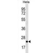 Large Ribosomal Subunit Protein uL16 (RPL10) Antibody