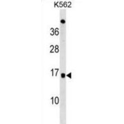 Ubiquitin-Conjugating Enzyme E2 D4 (UBE2D4) Antibody