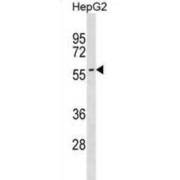 Sphingomyelin Phosphodiesterase 3 (SMPD3) Antibody