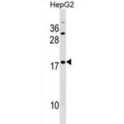 Sperm Protein Associated With The Nucleus On The X Chromosome D (SPANXD) Antibody