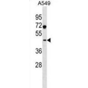 Surfeit 6 (SURF6) Antibody