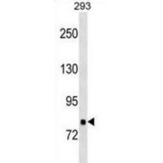 Tankyrase 1 Binding Protein 1 (TNKS1BP1) Antibody