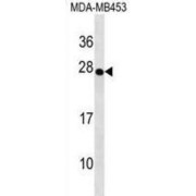 T-Cell Receptor Delta Chain C Region (TRDC) Antibody