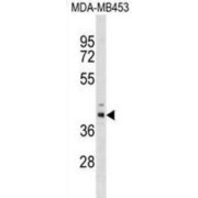 Mitochondrial tRNA-Specific 2-Thiouridylase 1 (TRMU) Antibody