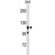 Ubiquitin Associated Protein 2 Like (UBAP2L) Antibody