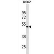 G Protein-Coupled Receptor 39 (GPR39) Antibody