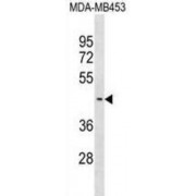 Suppressor of Variegation 3-9 Homolog 2 (SUV39H2) Antibody