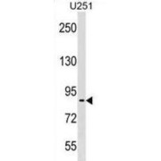 Pescadillo Ribosomal Biogenesis Factor 1 (PES1) Antibody