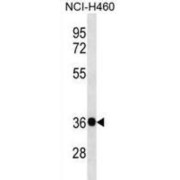 Guanine Nucleotide Binding Protein Subunit Beta 4 (GNB4) Antibody