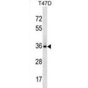 Bcl-2-Like Protein 12 (BCL2L12) Antibody