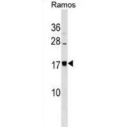 B-Cell Acute Lymphoblastic Leukemia-Expressed Protein (BLACE) Antibody