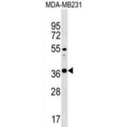 Chymotrypsinogen 2 (CTRB1) Antibody