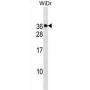 Mediator Of RNA Polymerase II Transcription Subunit 30 (MED30) Antibody
