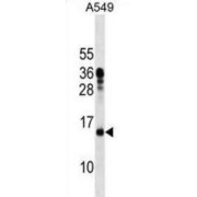 Mitochondrial Ribosomal Protein L11 (MRPL11) Antibody