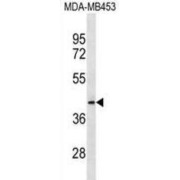 Mitochondrial Ribosomal Protein L46 (MRPL46) Antibody