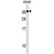Calcium Binding Protein 2 (CABP2) Antibody