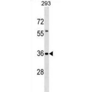 TRK-Fused Gene Protein (TFG) Antibody