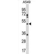 X-Linked Kx Blood Group (McLeod Syndrome) (XK) Antibody