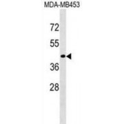 Cell Surface Glycoprotein CD200 Receptor 2 (CD200R2) Antibody