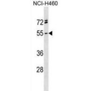 Repulsive Guidance Molecule A (RGMA) Antibody