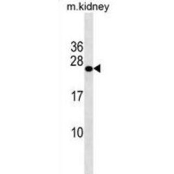 GrpE Protein Homolog 2, Mitochondrial (GRPEL2) Antibody