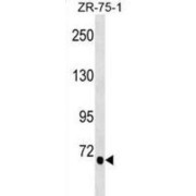 Transglutaminase 5 (TGM5) Antibody