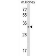 Probable Fructose-2,6-Bisphosphatase TIGAR (TIGAR) Antibody