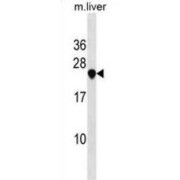 Vesicle Transport Protein USE1 (USE1) Antibody