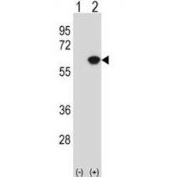 Nucleosome Assembly Protein 1 Like Protein 1 (NAP1L1) Antibody