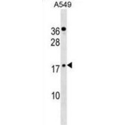 Zinc Finger Protein 663 (ZNF663) Antibody