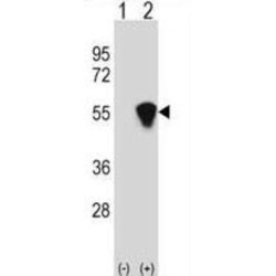 RuvB-Like 1/Pontin 52 (RUVBL1) Antibody