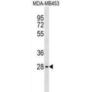 G Protein Beta Subunit Like Protein (GBL) Antibody