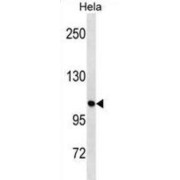 Serine/threonine-Protein Kinase ULK1 (ULK1) Antibody