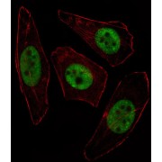 Unc-51 Like Autophagy Activating Kinase 2 (ULK2) Antibody