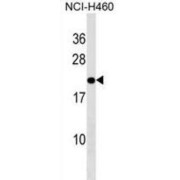 Transmembrane Emp24 Domain-Containing Protein 10 (TMED10) Antibody