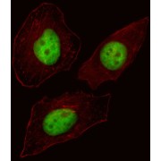Forkhead Box Protein N3 (FOXN3) Antibody