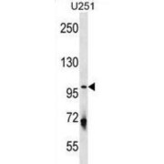 Serine/threonine-Protein Kinase ULK1 (ULK1) Antibody