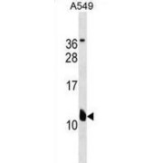 Potassium Voltage-Gated Channel Subfamily E Member 2 (KCNE2) Antibody