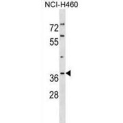 Quinone Oxidoreductase PIG3 (TP53I3) Antibody