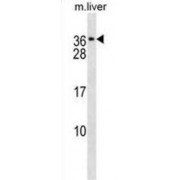 Voltage-Dependent Calcium Channel Gamma-1 Subunit (CACNG1) Antibody