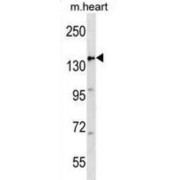 Adenomatous Polyposis Coli Protein (APC) Antibody