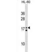 MGT4L Antibody