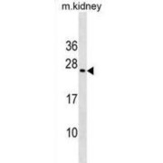 Homeobox Protein MIXL1 (MIXL1) Antibody