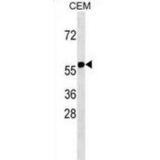E3 Ubiquitin-Protein Ligase RNF31 (RNF31) Antibody