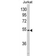 Microfibrillar-Associated Protein 1 (MFAP1) Antibody