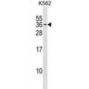 Polyamine-Modulated Factor 1 (PMF1) Antibody