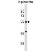 Carbohydrate Sulfotransferase 2 (CHST2) Antibody