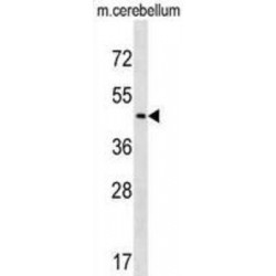 Carbohydrate Sulfotransferase 2 (CHST2) Antibody