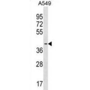 Signal Regulatory Protein Beta 1 (SIRPB1) Antibody